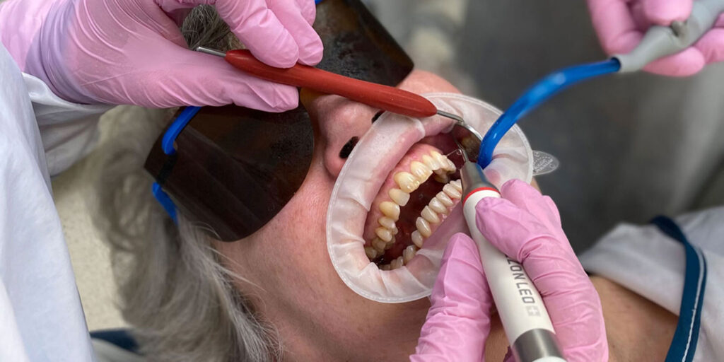 Guided Biofilm Therapy (GBT) - golden dental clinic