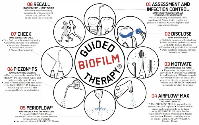What Is Guided Biofilm Therapy (GBT) - golden dental clinic