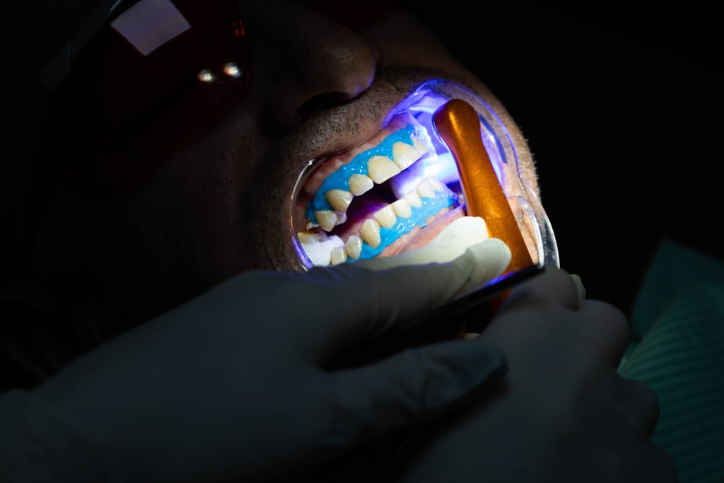 professional teeth whitening treatment at dental clinic